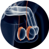 Urólogo – epididimitis Urólogo - epididimitis