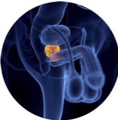 Urólogo – hiperplasia-prostática Urólogo - hiperplasia-prostática