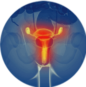 Urólogo – infección-urinaria Urólogo - infección-urinaria