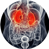 Urólogo – litiasis Urólogo - litiasis