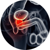 Urólogo – prostatitis Urólogo - prostatitis