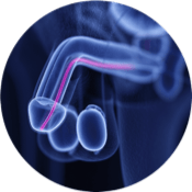 Urólogo – tratamiento-de-ETS Urólogo - tratamiento-de-ETS