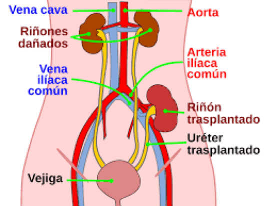 Urólogo - transpalnte-renal